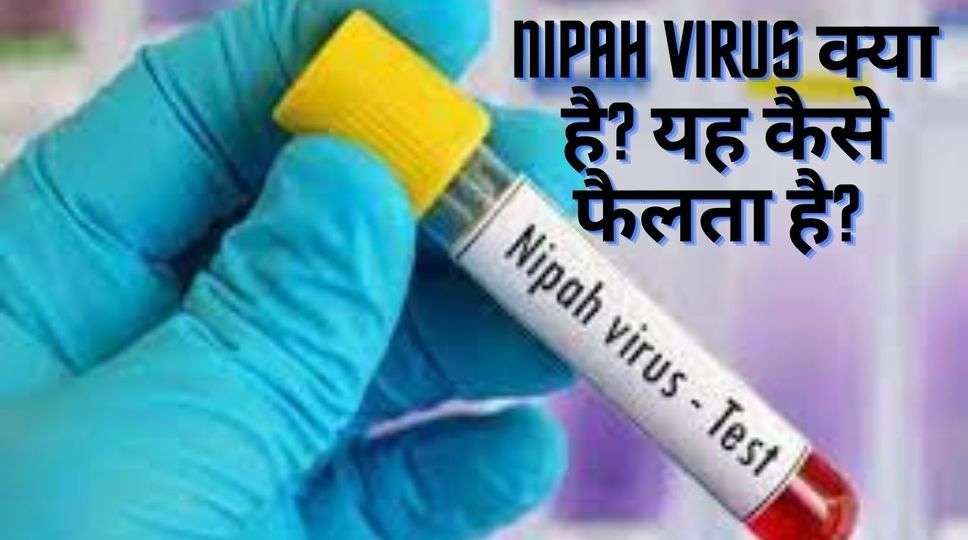 Nipah virus