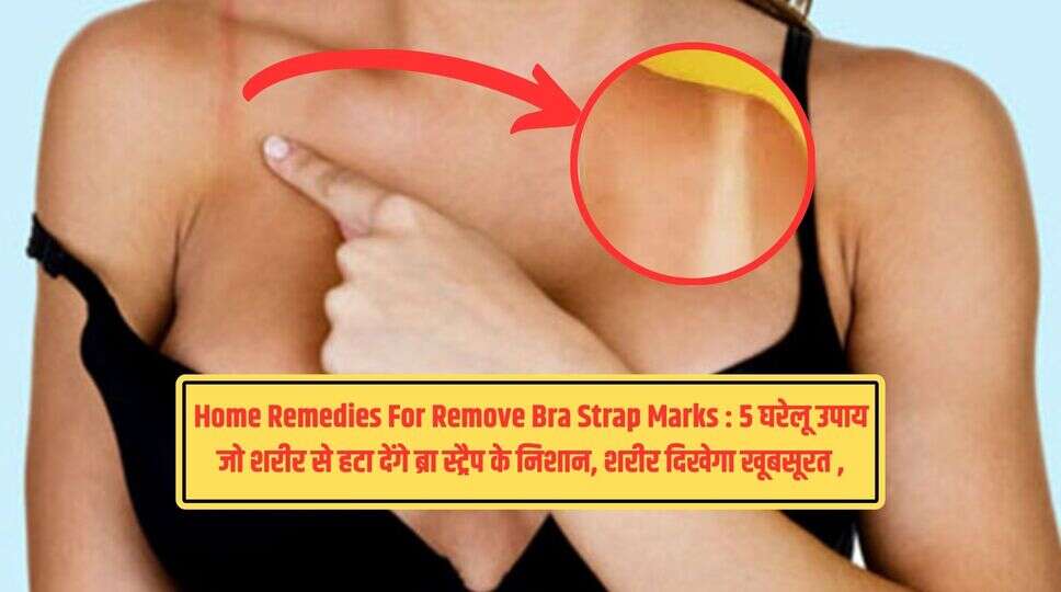 Home Remedies For Remove Bra Strap Marks : 5 घरेलू उपाय जो शरीर से हटा देंगे ब्रा स्ट्रैप के निशान, शरीर दिखेगा खूबसूरत , अभी देखिए नुस्खे&nbsp;
